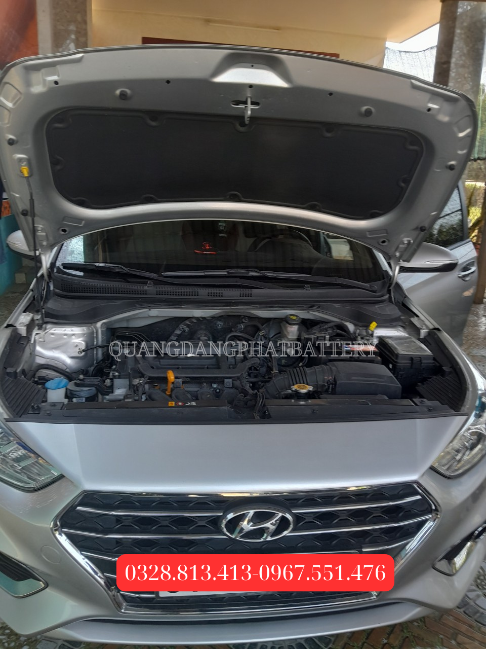 thay-ac-quy-xe-hyundai-accent-binh-duong